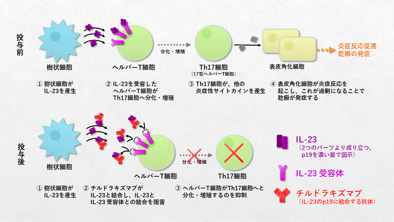 スキリジは使用します